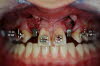 Ortodonzia ed impl car immed